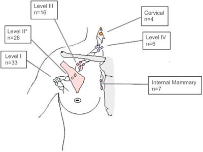 Simultaneous integrated boost within the lymphatic drainage system in breast cancer: A single center study on toxicity and oncologic outcome